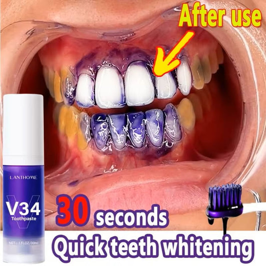 Perfect Purple Smile Gel