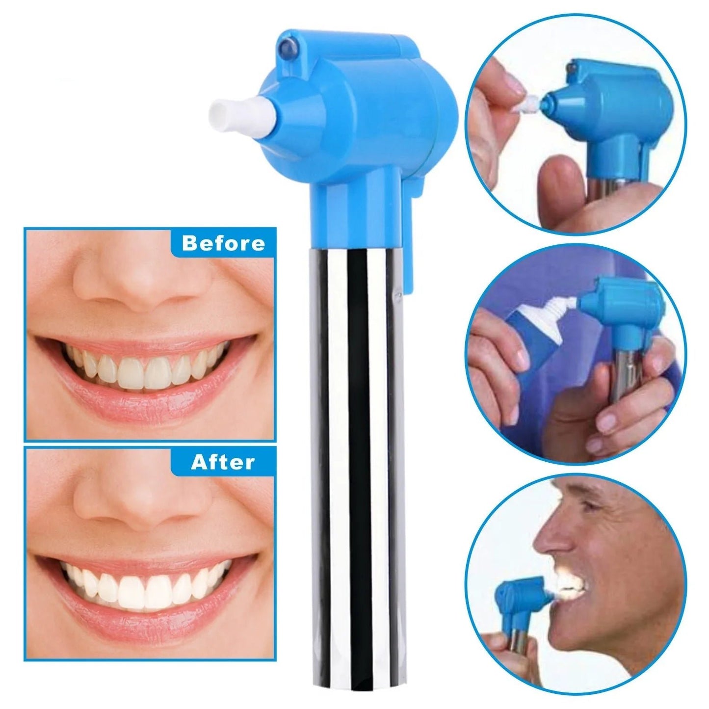 Ultrasonic Tooth Whitener & Polisher Pro