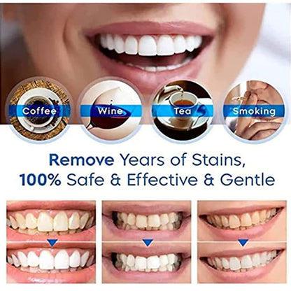 SnapFit TLOPA™ (Tartar Plaque Bacteria And Various Oral Problems Remover Teeth Whitening Serum)