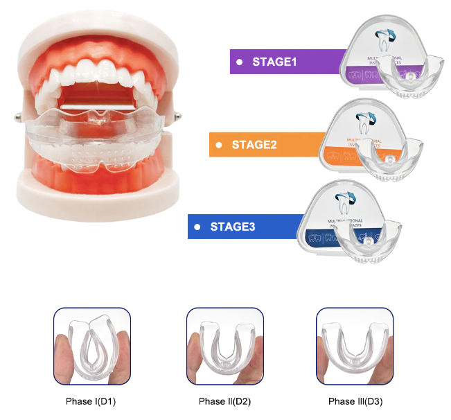 PerfectSmile™ Invisible Braces