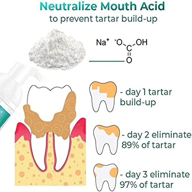 SnapFit TLOPA™ (Tartar Plaque Bacteria And Various Oral Problems Remover Teeth Whitening Serum)