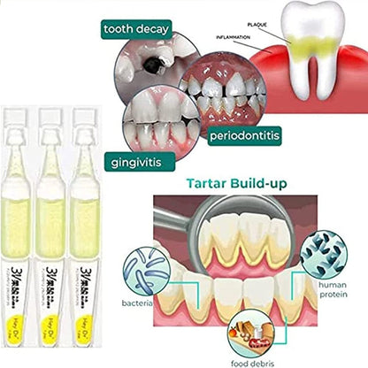 SnapFit TLOPA™ (Tartar Plaque Bacteria And Various Oral Problems Remover Teeth Whitening Serum)