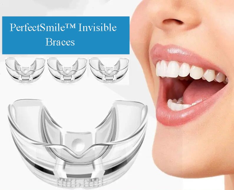 PerfectSmile™ Invisible Braces